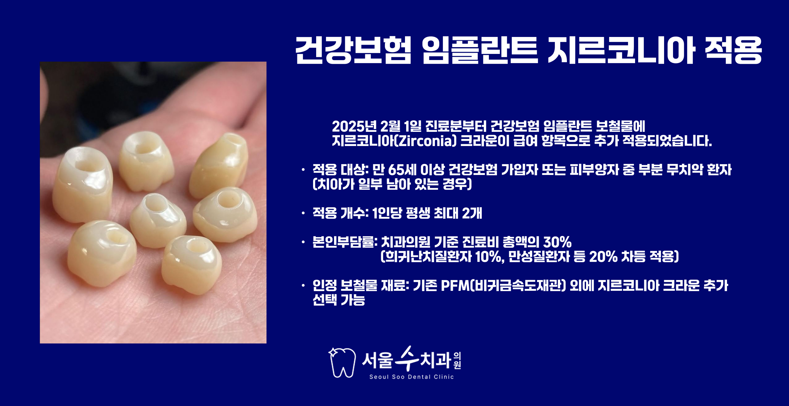 건강보험 임플란트 지르코니아 크라운 설명 이미지